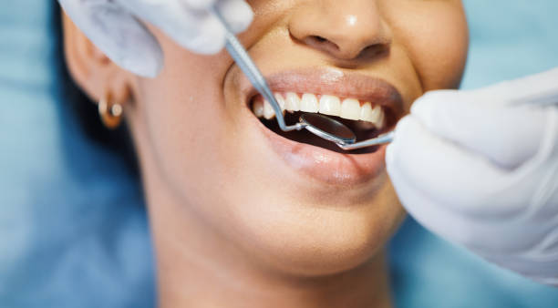 Best Urgent Care for Lost Fillings or Crowns in Greenfield, OH