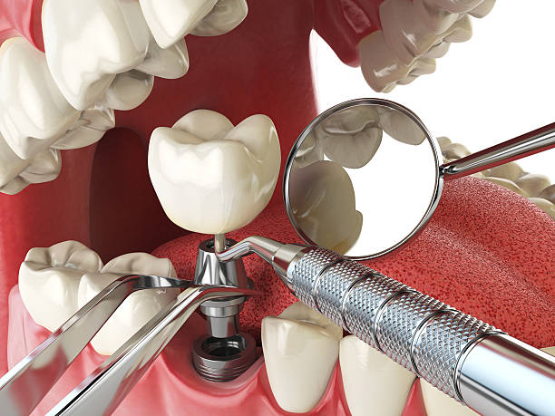 Best Emergency Gum Treatment in Greenfield, OH